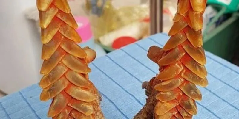 Vảy gà là gì?